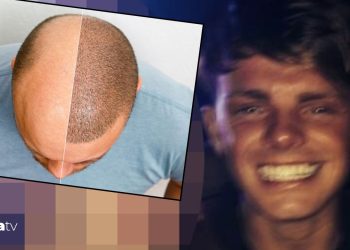 İngiltere’yi dolandırdı Türkiye’de ameliyat oldu